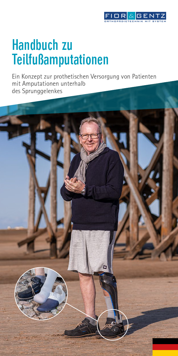 Handbuch zu Teilfußamputationen Handbuch zu Teilfußamputationen
